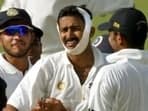 Anil Kumble reveals what inspired him to bowl with broken jaw