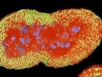 The Neisseria gonorrhea bacterium: Most women who get the STI gonorrhea are asymptomatic, which puts them at higher risk than men, who unmistakably know when they've got it. 